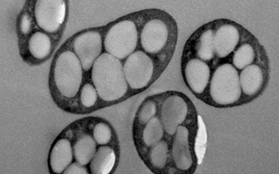 Investigadores modelan bacteria “terminator” contra la acumulación de plásticos